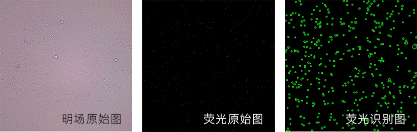 图像法自动化的血小板计数