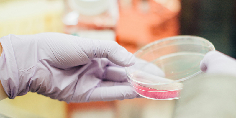 活菌计数效率瓶颈如何破？博大博聚微生物细胞计数仪的实践方案