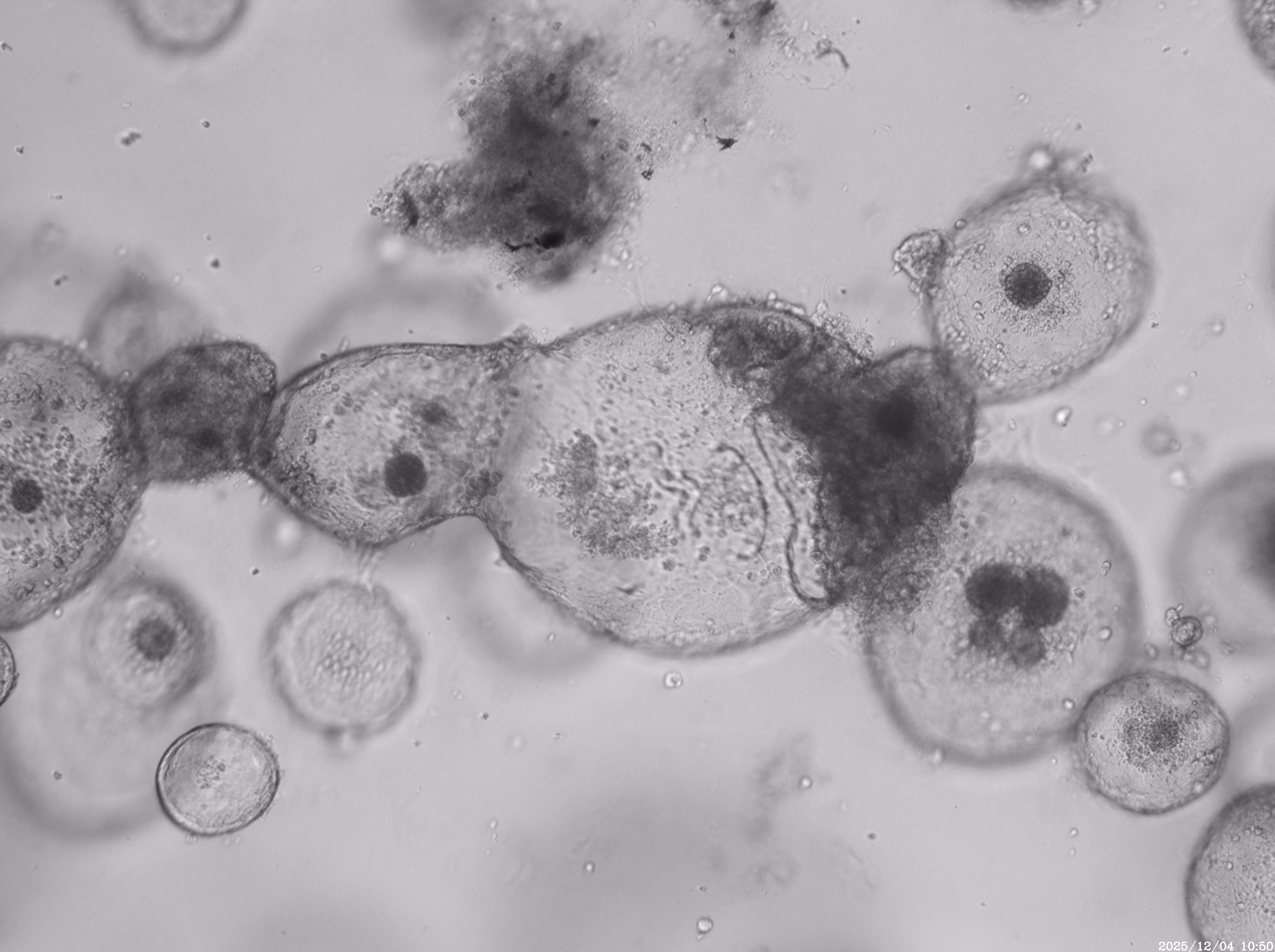 案例分享：小鼠子宫内膜类器官长时程生长监测