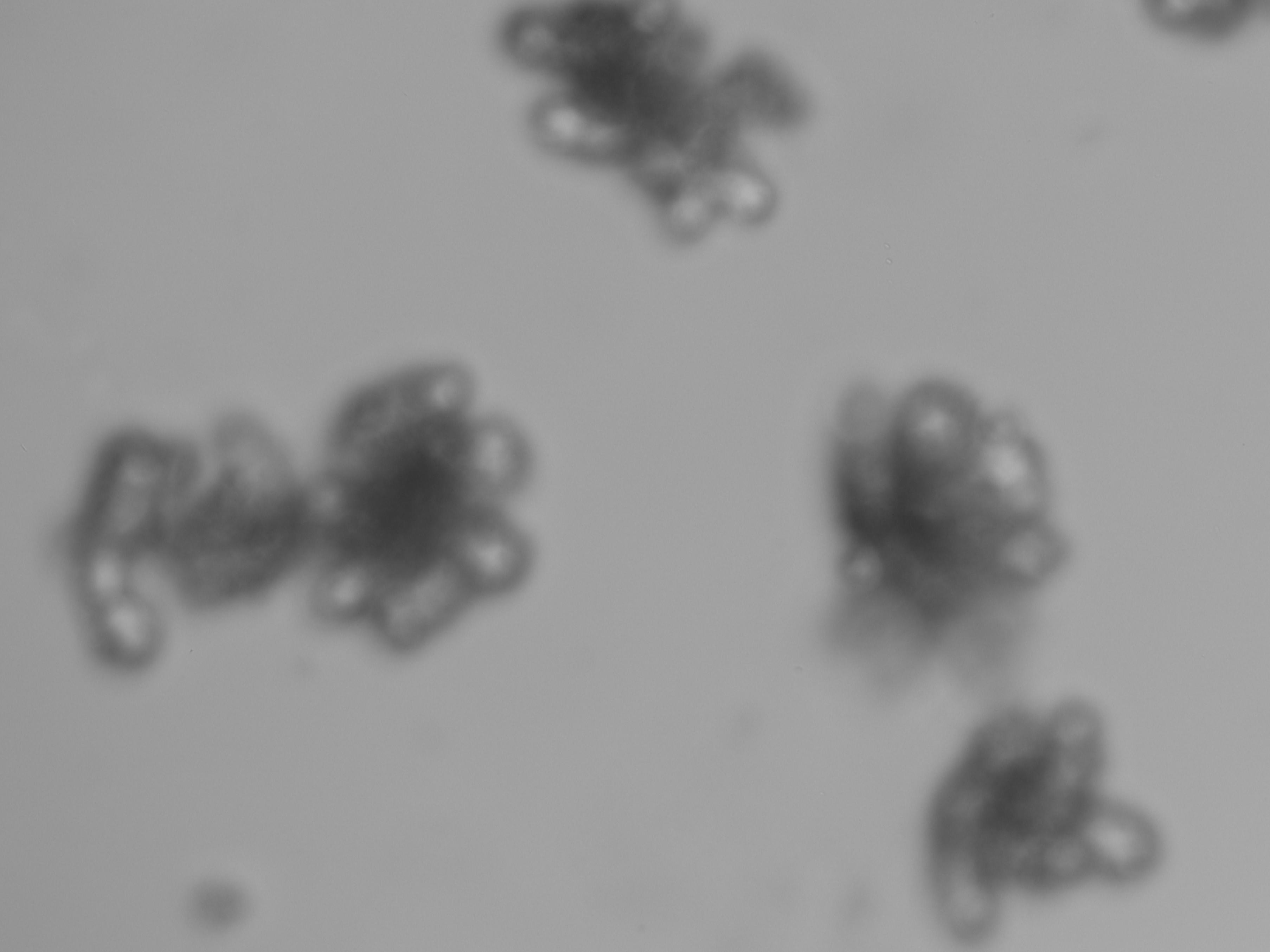 案例分享：小鼠小肠类器官Z轴多层扫描成像