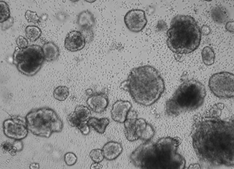 Organoid imaging analysis